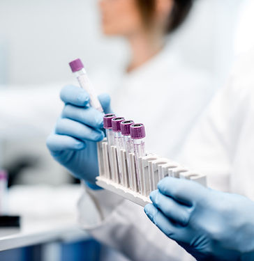 Biomarcadores en 1er y 2do HIT Séptico