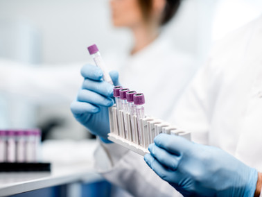 Внесення до Реєстру DIA®-D-dimer-ELISA