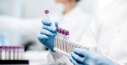 Revvity Announces FDA Clearance for First Automated Free Testosterone Test