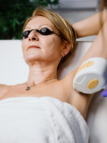 Laser Hair Removal