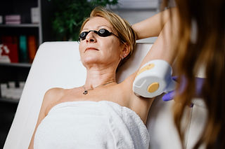 Laser Hair Removal