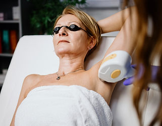 Laser Hair Removal