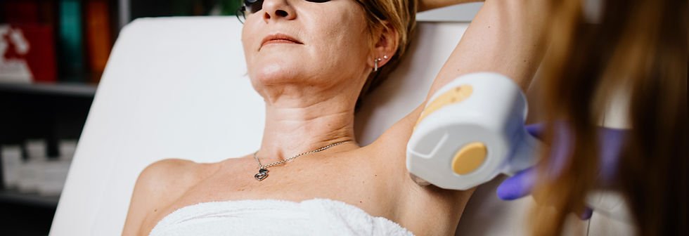 Laser Hair Removal
