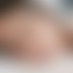 Sleeptember: The Skin-Sleep Connection