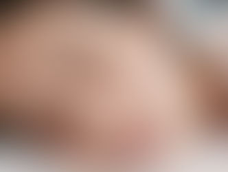Sleeptember: The Skin-Sleep Connection