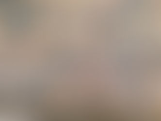 City Beach Supervision Ends August 24 – No Extension to Labour Day