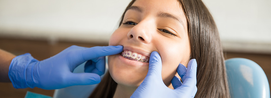 Braces