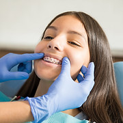 Braces