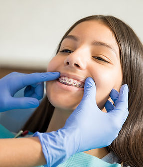 Un appareil dentaire