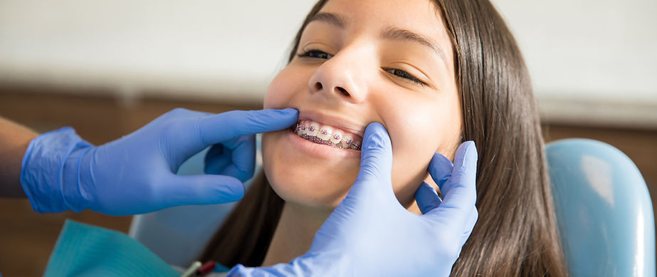 Braces