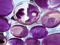 Petri Dishes