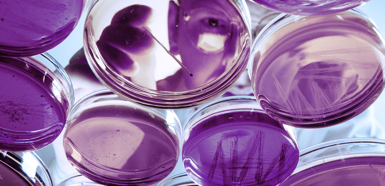 Petri Dishes with Experiment