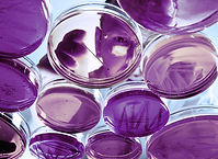 Purple Petri Dishes