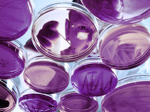 Invisibility cloaks and urinary tract infections