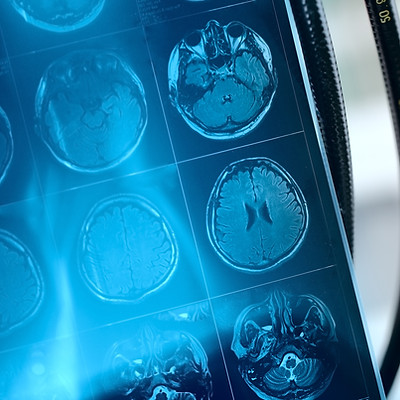 MRI Scan Image