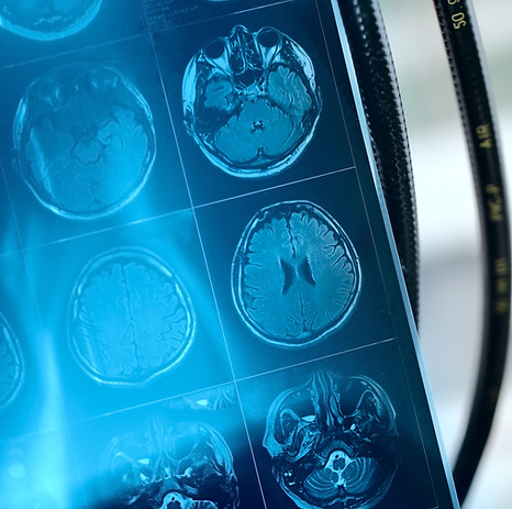 MRI Scan Image