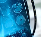 MRI Tarama Görüntüsü
