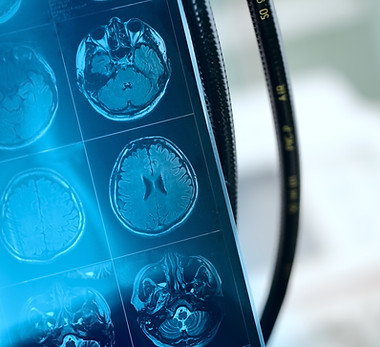 Imagem de ressonância magnética