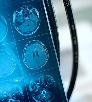 Imagem de ressonância magnética