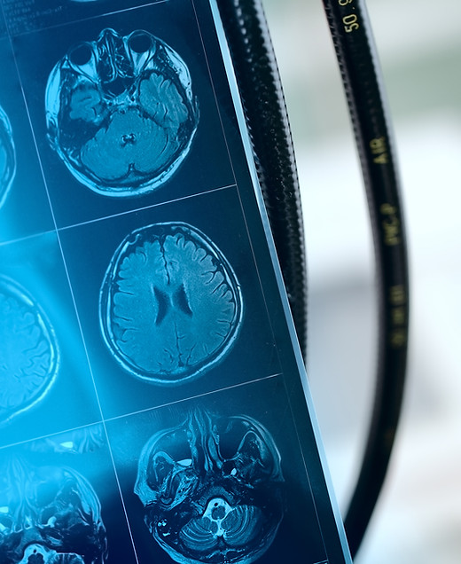 MRI Scan Image