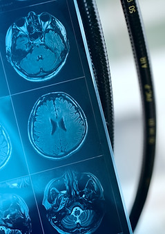 MRI Scan Image