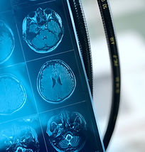 Imagem de ressonância magnética