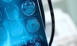 UroExpert Prostate Biopsy