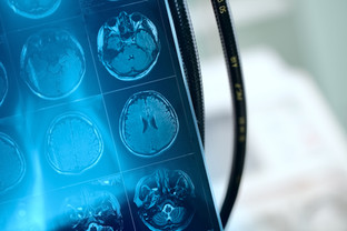 MRI Scan Image