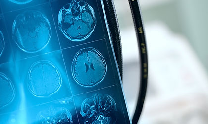 MRI Scan Image