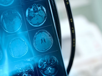 Breakdown of the NFL’s Concussion Investigation and Possible Future Legal Disputes