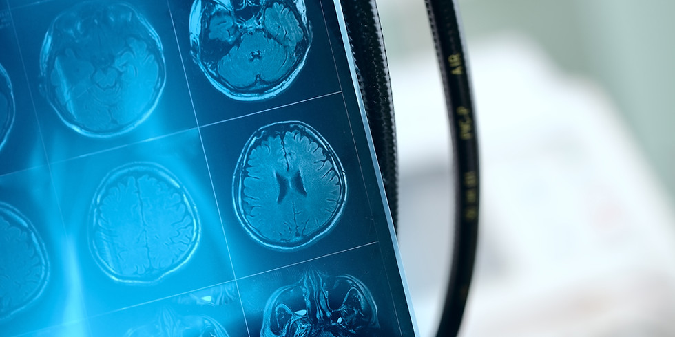 Berner Arbeitsgruppe ADHS: ADHS und Neurofeedback