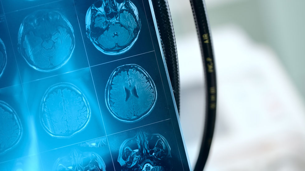 Neuroradiology Curriculum for Neurology Residents