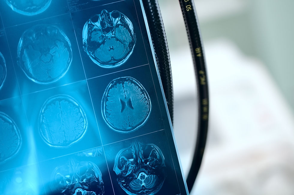 MRI Scan Image