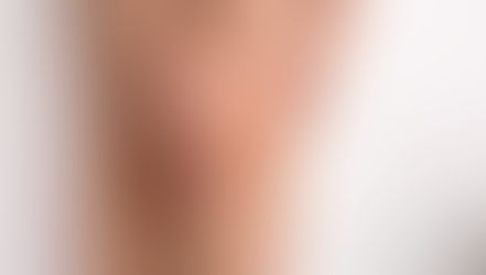 oint-related conditions that cause inflammation, pain, stiffness, and swelling in the joints