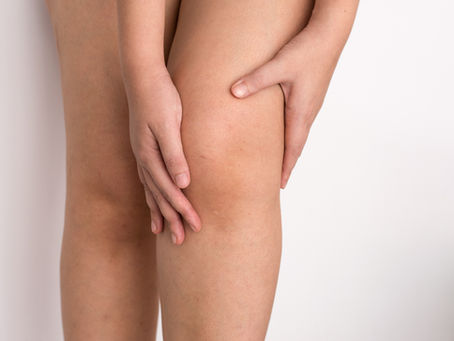 Love Your Knees: Simple Tips for Keeping Them Healthy and Happy