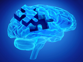 Considerations for People Diagnosed with Younger Onset Alzheimer's
