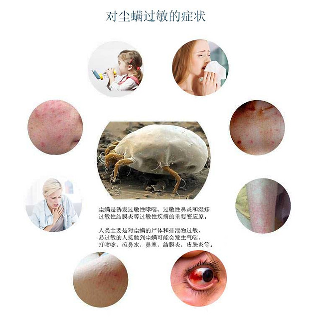 尘螨敏感症状 .jpg