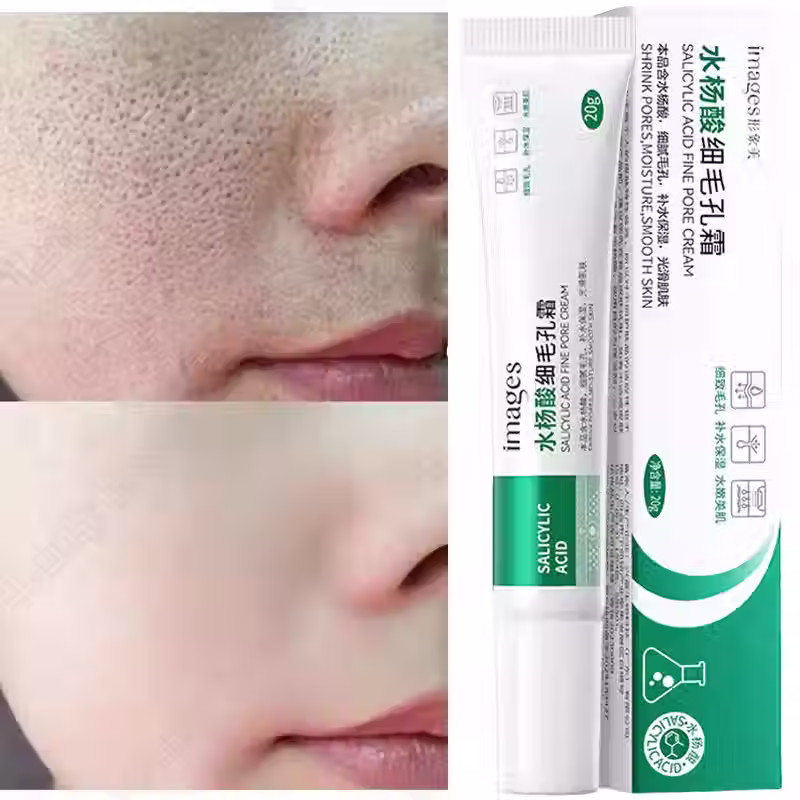 Miniatura: Gel Secativo Antiacne Herbal – Redução Rápida de Espinhas, Uniformização da Pele
