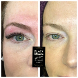 before & after