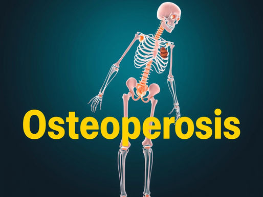 Understanding Osteoporosis