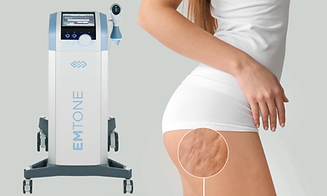 Capture d’écran 2025-11-17 à 23.04.49.png