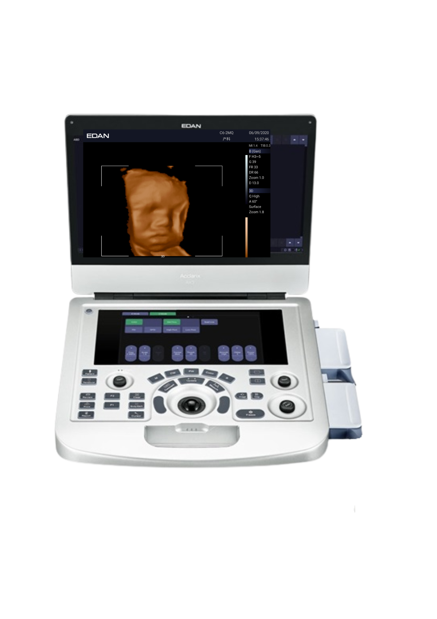 AX3 EDAN Ginecología