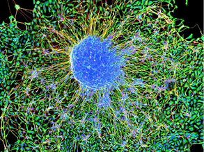 Turning Skin Into Brain