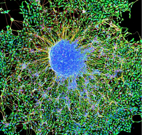 Turning Skin Into Brain