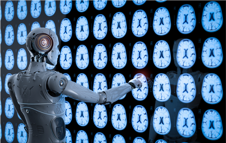 Will AI Replace Radiologists?