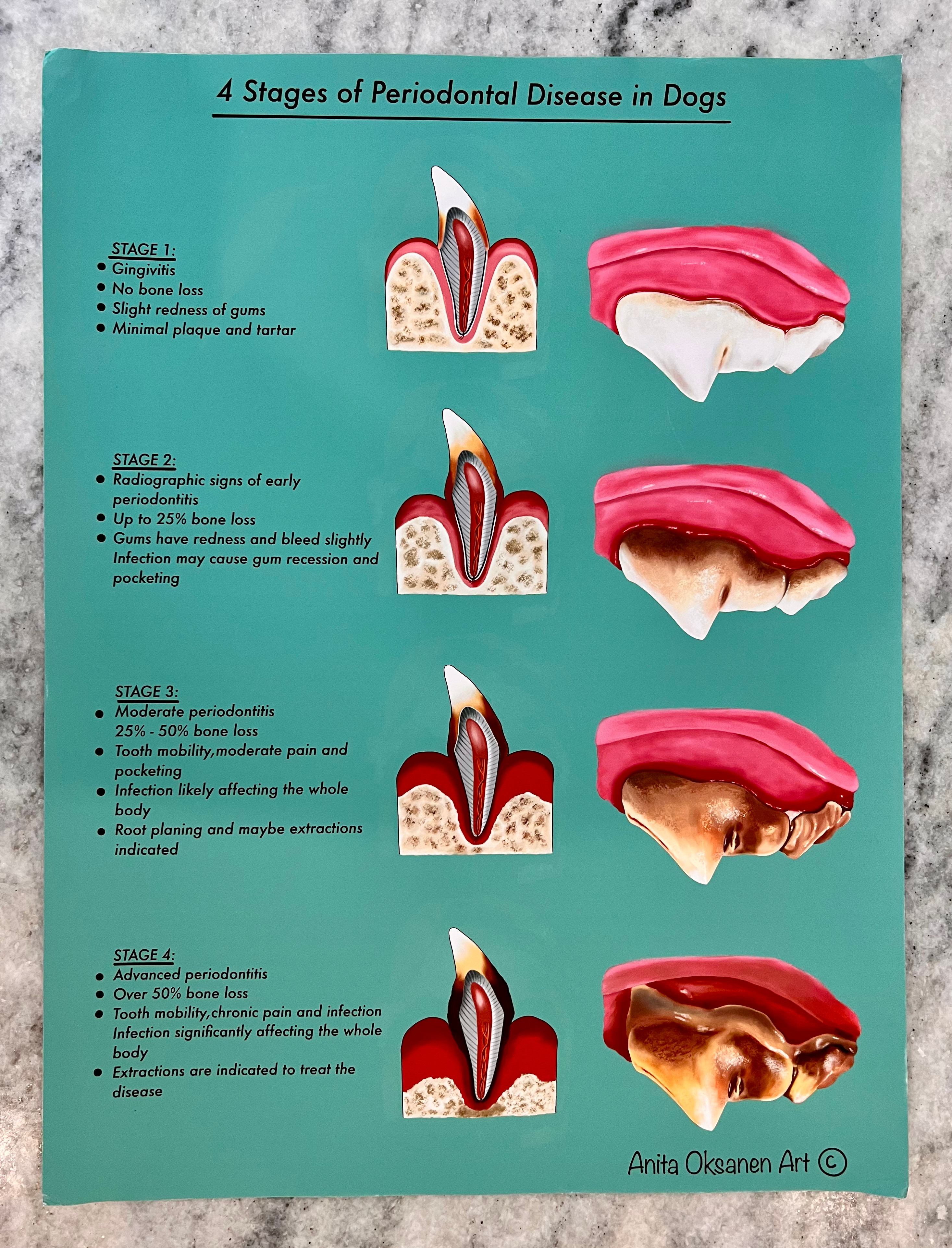 (Half Price) Periodontal Disease Poster (Crinkled Corners)