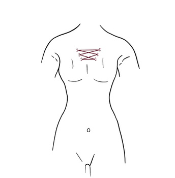604_Korsett