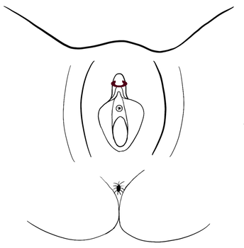 707_KVH