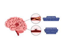 Stroke in Dogs: Understanding Signs, Causes and What Owners Should Know