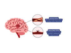 Stroke in Dogs: Understanding Signs, Causes and What Owners Should Know